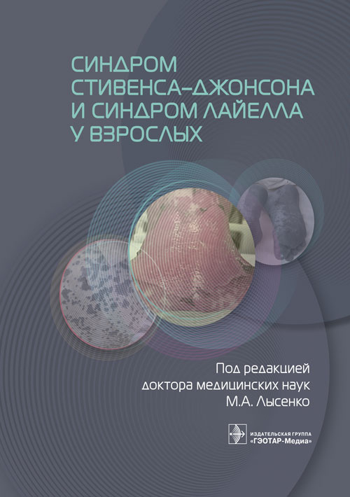 Книга 'Синдром Стивена-Джонсона и синдром Лайелла у взрослых`